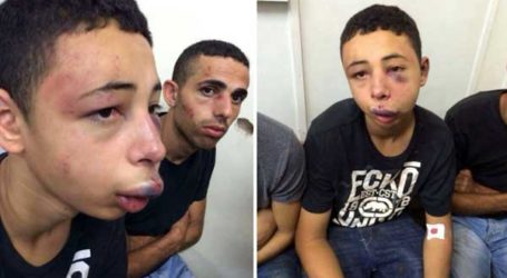 ISRAEL HOLDS US BOY WITHOUT CHARGE AFTER POLICE NEARLY BEAT HIM TO DEATH