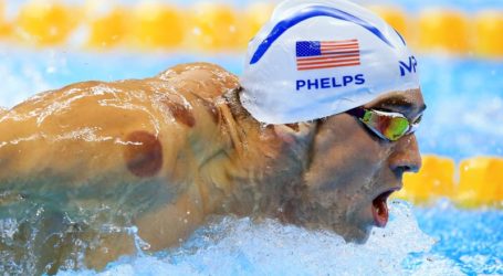 Cupping Therapy Trend Among Athletes In Rio Olympic