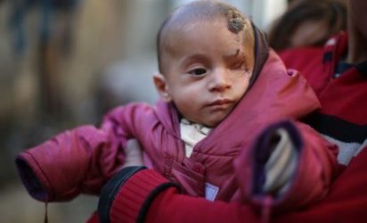 Baby Symbol of Syrian Civilians’ Plight Safe in Turkey