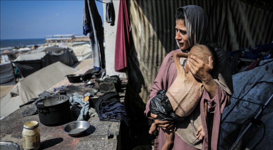 Palestinian in Gaza starvation (photo: Anadolu Agency)
